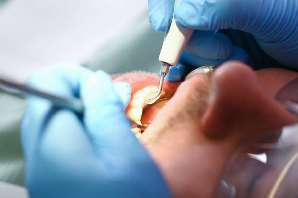 Best Emergency Root Canal Treatment in Tontitown, AR