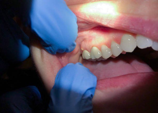 Best Weekend Emergency Dentist in Tontitown, AR