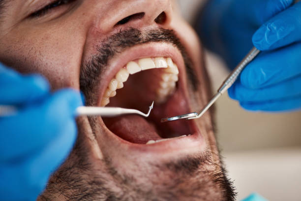 Best Same-Day Emergency Dentist in Tontitown, AR